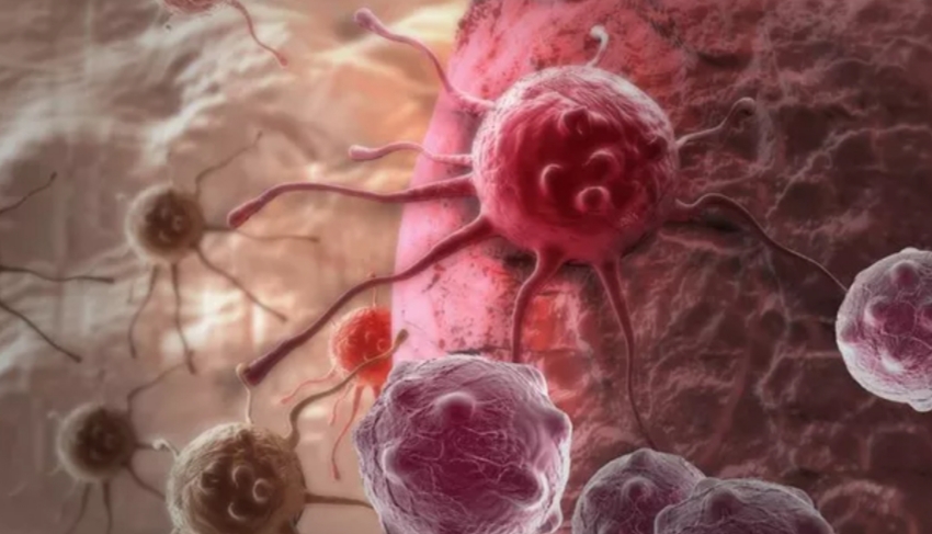 Banyak Kasus Kanker di Usia Muda, Ini Penyebabnya