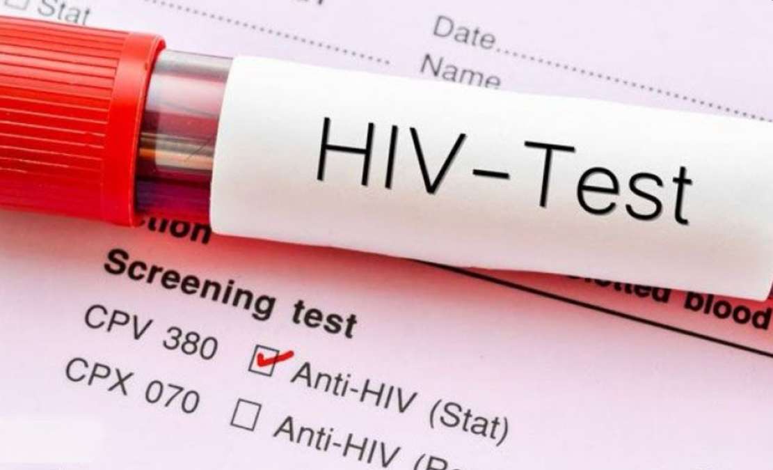 Hingga Oktober 2025, Kasus HIV di Jawa Timur Turun Jadi 8.962