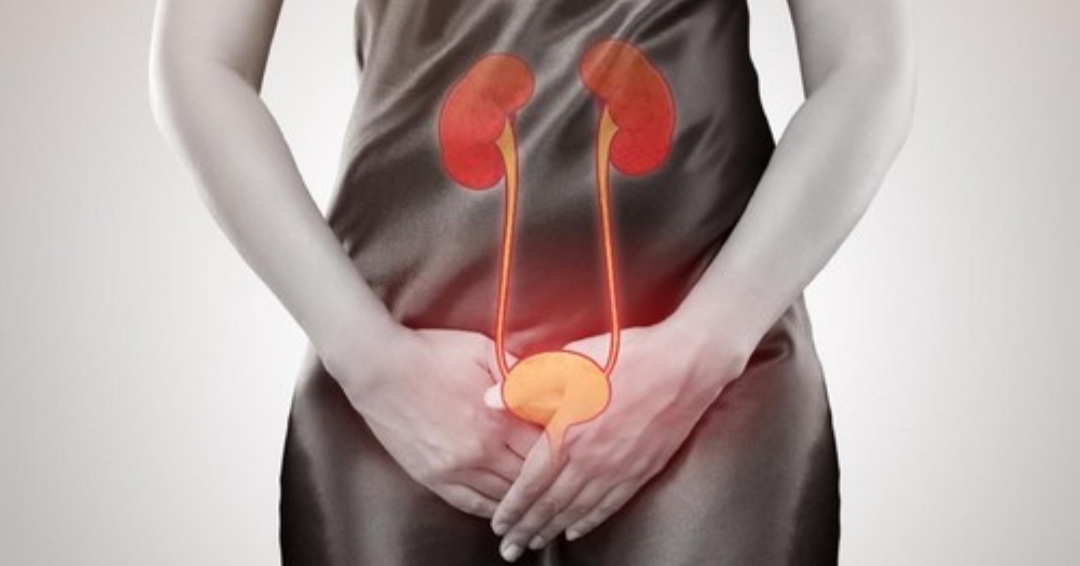 Cegah Infeksi Saluran Kemih saat Puasa, Ini Anjuran Urolog