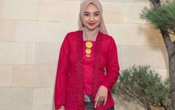 Ria Ricis Jawab Isu Oplas: Estetik Sekaligus Bikin Bisa Napas